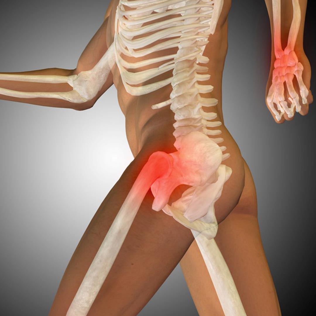 You are currently viewing Injury blog: Side Hip Pain