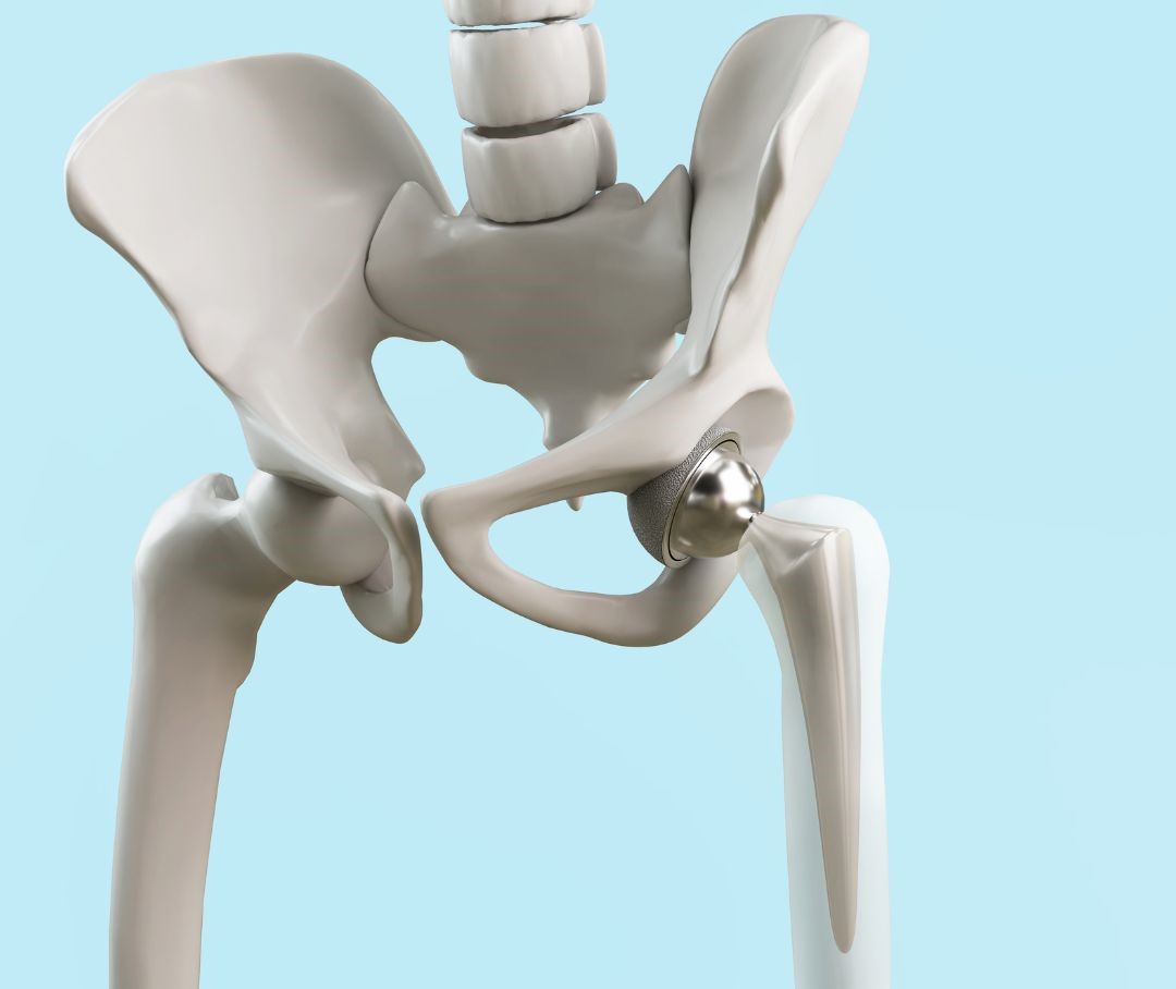 You are currently viewing How Osteopaths Can Help With Hip Health & Hip Replacements