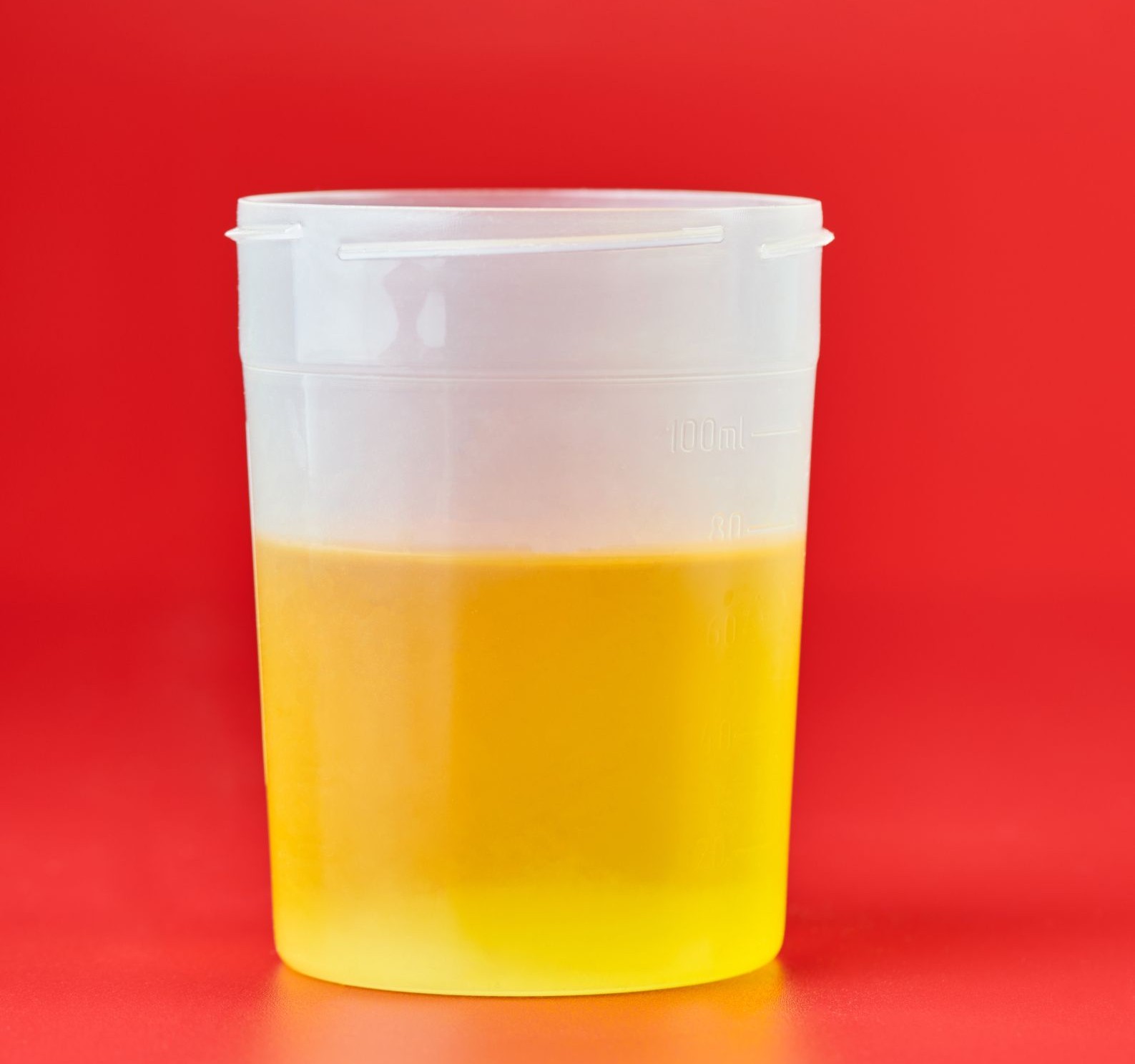 You are currently viewing Ever Wondered What Healthy Pee Looks Like?