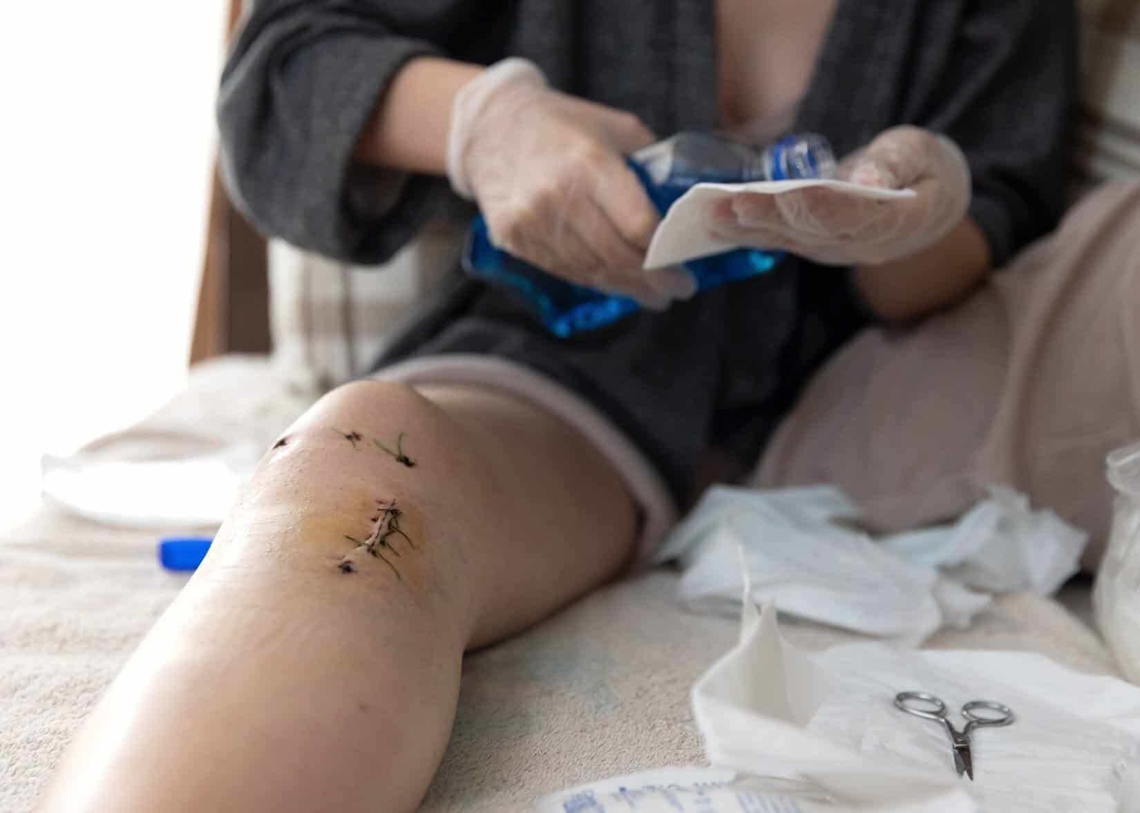 You are currently viewing Osteopathy for post-surgical recovery